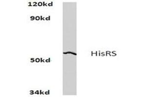Image no. 1 for anti-Histidyl-tRNA Synthetase (HARS1) antibody (ABIN272164)
