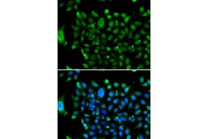Immunofluorescence analysis of U2OS cells using NCOR1 antibody. (NCOR1 anticorps)