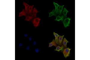 ABIN6258162 and ABIN6275961 staining Hela cells by IF/ICC. (GPR160 anticorps  (C-Term))