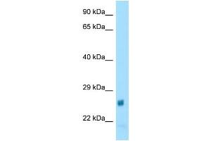 WB Suggested Anti-Naa60 Antibody Titration: 1. (NAT15 anticorps  (N-Term))