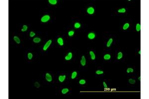 Immunofluorescence of monoclonal antibody to HMGB2 on HeLa cell. (HMGB2 anticorps  (AA 1-195))