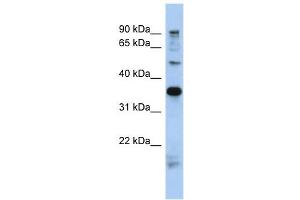 MGC70924 antibody used at 1 ug/ml to detect target protein. (PRR19 anticorps  (N-Term))