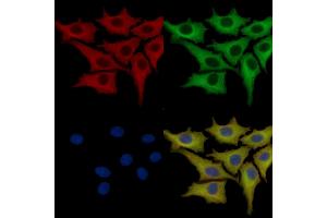 ABIN7093776 and ABIN7097817 staining HepG2 cells by IF/ICC.
