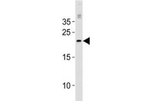 MGMT antibody western blot analysis in MCF-7 lysate.