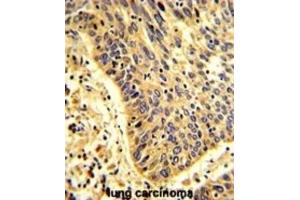 Immunohistochemistry (IHC) image for anti-Pleckstrin Homology Domain Containing, Family G (With RhoGef Domain) Member 6 (PLEKHG6) antibody (ABIN3002882)