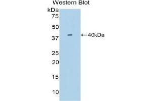 Detection of Recombinant SIGIRR, Mouse using Polyclonal Antibody to Single Ig IL1 Related Receptor (SIGIRR) (SIGIRR anticorps  (AA 1-117))