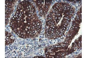 Image no. 2 for anti-Tumor Protein D52-Like 3 (TPD52L3) antibody (ABIN1501475)