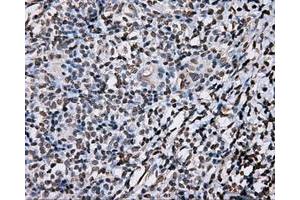 Immunohistochemical staining of paraffin-embedded liver tissue using anti-DAPK2 mouse monoclonal antibody. (DAPK2 anticorps)