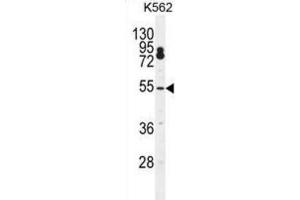 Western Blotting (WB) image for anti-Cleavage and Polyadenylation Specific Factor 7, 59kDa (CPSF7) antibody (ABIN2996552) (CPSF7 anticorps)