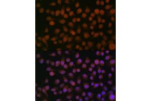 Immunofluorescence analysis of HeLa cells using Emerin/EMD Rabbit mAb (ABIN7266933) at dilution of 1:100 (40x lens). (Emerin anticorps)