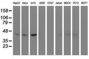 Image no. 8 for anti-NudE Nuclear Distribution E Homolog (A. Nidulans)-Like 1 (NDEL1) antibody (ABIN1499853)