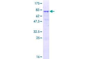 T-Complex 10 (TCP10) (AA 1-353) protein (GST tag)