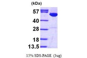 SDS-PAGE (SDS) image for Inosine 5'-Phosphate Dehydrogenase 1 (IMPDH1) (AA 1-514) protein (His tag) (ABIN667787) (IMPDH1 Protein (AA 1-514) (His tag))