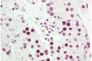 Human Testis: Formalin-Fixed, Paraffin-Embedded (FFPE) (NR2F2 anticorps  (AA 1-30))