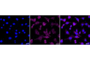 Immunocytochemical staining of C2C12 cells with LY6A antibody (ABIN7799289), 1:1,000).