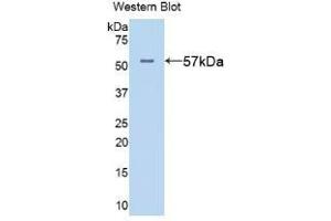 WB of Protein Standard: different control antibodies against Highly purified E. (ALT Kit CLIA)