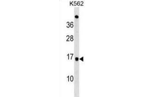Western Blotting (WB) image for anti-Ubiquitin-Conjugating Enzyme E2D 4 (UBE2D4) antibody (ABIN3000670) (UBE2D4 anticorps)