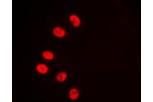 Immunofluorescent analysis of NR2F6 staining in HepG2 cells.