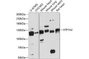 Western blot analysis of extracts of various cell lines, using  antibody (ABIN6129199, ABIN6137302, ABIN6137303 and ABIN6217930) at 1:3000 dilution. (ATP1A2 anticorps  (AA 1-70))