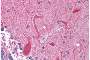 Human Brain, Cerebellum (formalin-fixed, paraffin-embedded) stained with PEG3 antibody ABIN214135 at 5 ug/ml followed by biotinylated goat anti-rabbit IgG secondary antibody ABIN481713, alkaline phosphatase-streptavidin and chromogen.