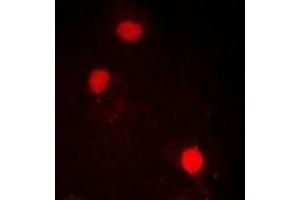 Immunofluorescent analysis of SOX2 staining in MCF7 cells.