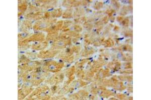 IHC-P analysis of Heart tissue, with DAB staining. (CTGF anticorps  (AA 248-349))