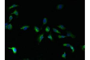 Immunofluorescent analysis of U251 cells using ABIN7165738 at dilution of 1:100 and Alexa Fluor 488-congugated AffiniPure Goat Anti-Rabbit IgG(H+L) (TMBIM1 anticorps  (AA 1-109))