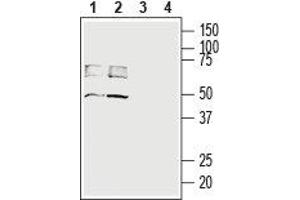 Western blot analysis of rat (lanes 1 and 3) and mouse (lanes 2 and 4) brain lysates: - 1,2. (SLC16A3 anticorps  (C-Term, Intracellular))