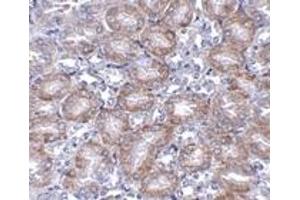 Immunohistochemistry (IHC) image for anti-Mitochondrial Carrier 2 (MTCH2) (N-Term) antibody (ABIN1031463) (MTCH2 anticorps  (N-Term))