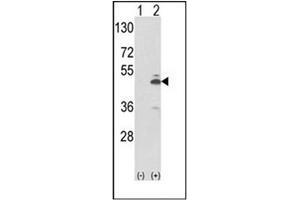 Western blot analysis of PKM2 (arrow) using PKM2 Antibody (N-term) Cat. (PKM2 anticorps  (N-Term))