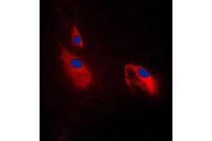 Immunofluorescent analysis of PFKP staining in NIH3T3 cells. (PFKP anticorps  (Center))