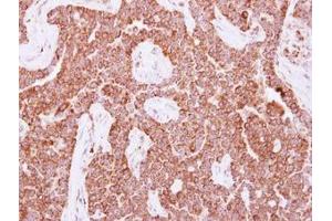 Image no. 1 for anti-Nudix (Nucleoside Diphosphate Linked Moiety X)-Type Motif 3 (NUDT3) (AA 1-172) antibody (ABIN1499863)