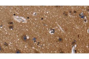 Immunohistochemistry of paraffin-embedded Human brain using FGFR1OP Polyclonal Antibody at dilution of 1:40 (FGFR1OP anticorps)