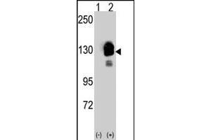 Western blot analysis of CDH8 (arrow) using rabbit CDH8 polyclonal antibody . (Cadherin 8 anticorps  (N-Term))