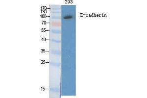 Western Blotting (WB) image for anti-Cadherin 1, Type 1, E-Cadherin (Epithelial) (CDH1) (C-Term) antibody (ABIN3184389) (E-cadherin anticorps  (C-Term))