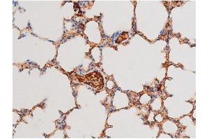 ABIN6267526 at 1/200 staining Mouse lung tissue sections by IHC-P.