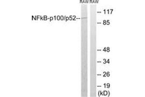 Western blot analysis of extracts from RAW264. (NFKB2 anticorps  (AA 836-885))
