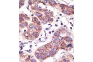 Image no. 2 for anti-Ubiquitin Specific Peptidase 3 (USP3) (N-Term) antibody (ABIN357523) (USP3 anticorps  (N-Term))