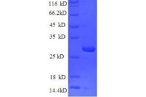 Nidogen 1 (NID1) (AA 428-665) protein (His tag)
