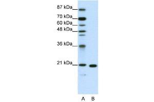 WB Suggested Anti-RPL9  Antibody Titration: 1. (RPL9 anticorps  (C-Term))