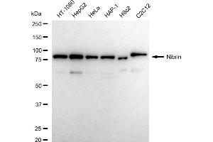 Western blotting analysis using Nibrin antibody (ABIN7799592).