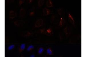 Immunofluorescence analysis of U-2 OS cells using CHP1 Polyclonal Antibody at dilution of 1:100. (CHP anticorps)
