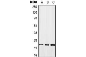 Western blot analysis of GADD45 beta expression in MCF7 (A), NIH3T3 (B), H9C2 (C) whole cell lysates. (GADD45B anticorps  (C-Term))
