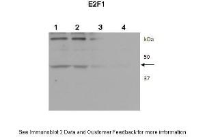 Lanes:  1. (E2F1 anticorps  (Middle Region))