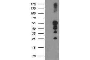 Western Blotting (WB) image for anti-Protein tyrosine Phosphatase, Non-Receptor Type 1 (PTPN1) antibody (ABIN1500495) (PTPN1 anticorps)