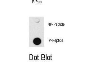 Image no. 1 for anti-SMAD Family Member 4 (SMAD4) (pThr277) antibody (ABIN358227) (SMAD4 anticorps  (pThr277))