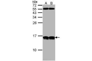 WB Image Sample (30 ug of whole cell lysate) A: HeLa B: Hep G2 , 12% SDS PAGE antibody diluted at 1:1000 (NHP2L1 anticorps  (full length))