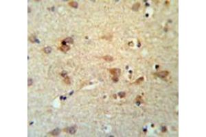 Immunohistochemistry analysis in brain tissue (Formalin-fixed, Paraffin-embedded) using LCAT  Antibody , followed by peroxidase conjugation of the secondary antibody and DAB staining.