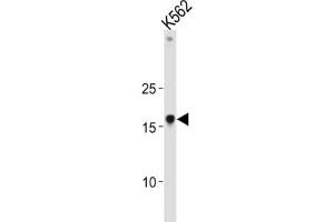 Western Blotting (WB) image for anti-High Mobility Group AT-Hook 1 (HMGA1) antibody (ABIN3004034) (HMGA1 anticorps)
