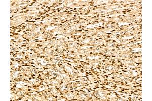 anti-Mars (MARS) (Internal Region) antibody